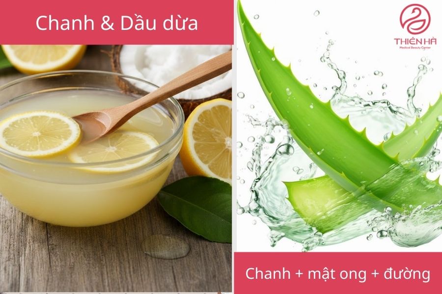 Cách trị thâm háng hiệu quả cao và an toàn 