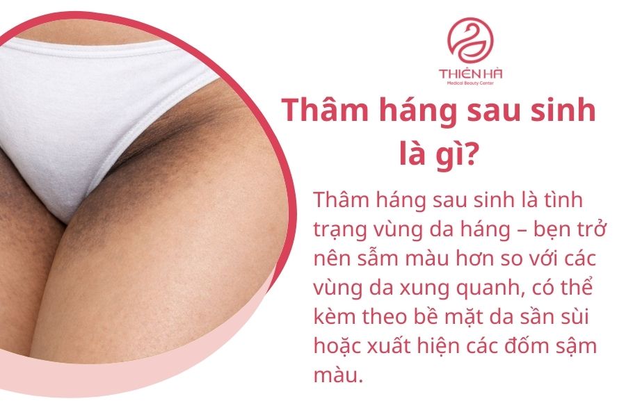 Thâm háng sau sinh là gì?