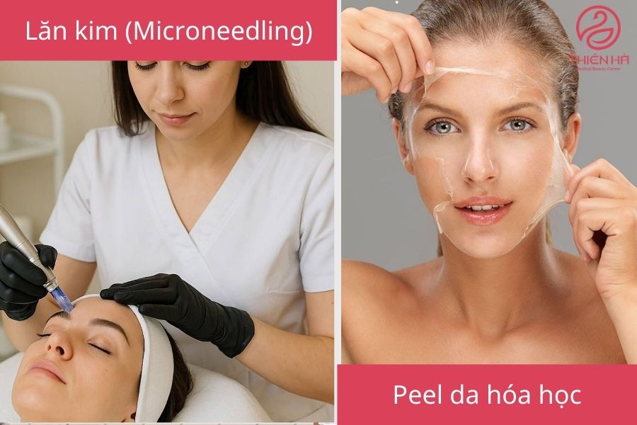 Cách trị thâm trên mặt chuyên sâu, nhanh và hiệu quả