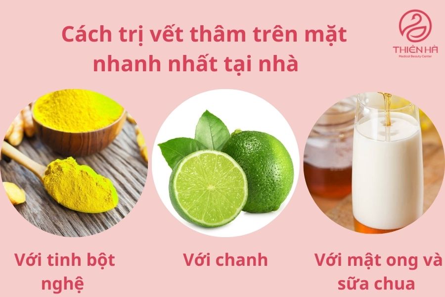Cách trị vết thâm trên mặt nhanh nhất tại nhà