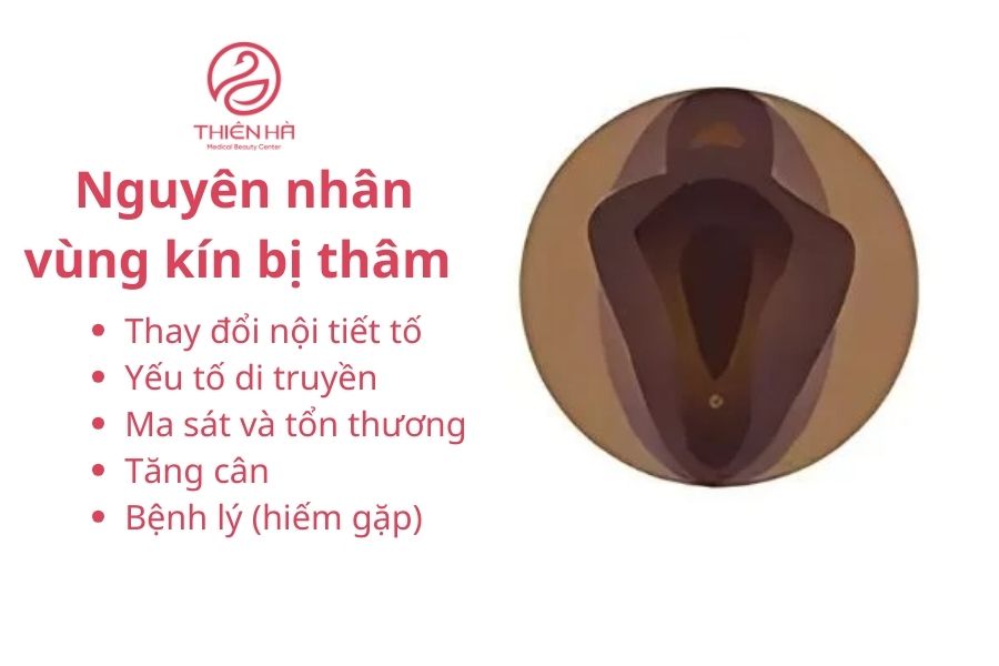 Nguyên nhân cô bé bị thâm 