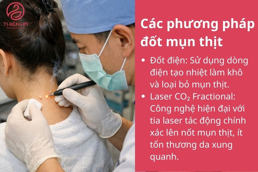 Các phương pháp đốt mụn thịt