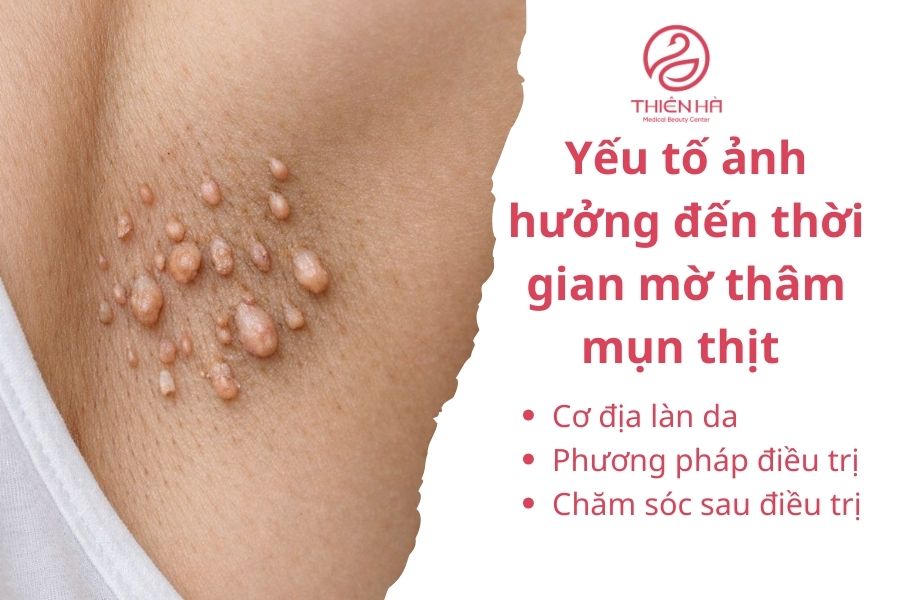Yếu tố nào ảnh hưởng đến thời gian mờ thâm