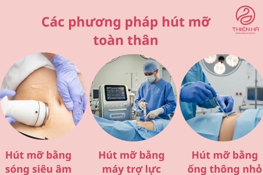 Các phương pháp hút mỡ toàn thân