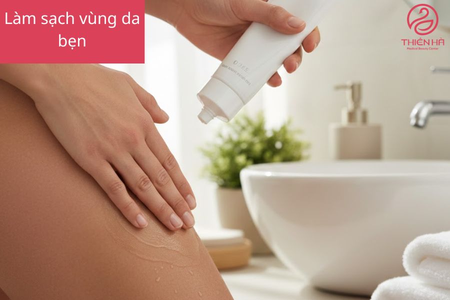 Cách sử dụng kem trị thâm bẹn để đạt hiệu quả tối ưu