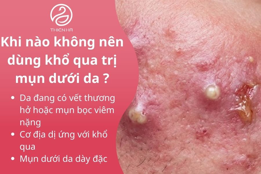 Khi nào không nên dùng khổ qua