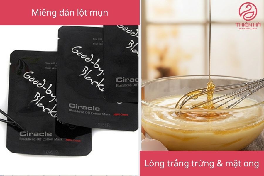 Lột mụn đầu đen an toàn và hiệu quả: Quy trình chi tiết từng bước 2 Các phương pháp lột mụn đầu đen hiệu quả