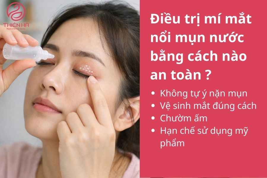 Mí mắt nổi mụn nước: Nguyên nhân, dấu hiệu & cách xử lý an toàn 3 Điều trị mí mắt nổi mụn nước bằng cách nào an toàn?
