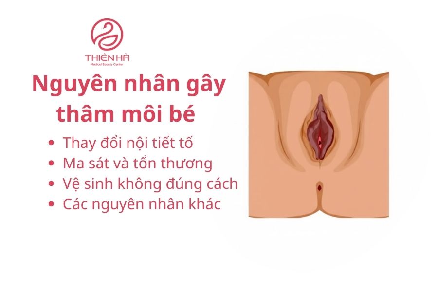 Nguyên nhân gây thâm môi bé