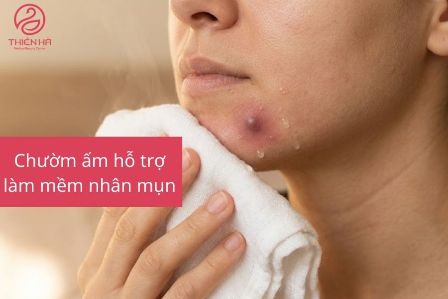 Mụn bị chai cứng dưới da phải làm sao? Cách xử lý an toàn 3 Chườm ấm
