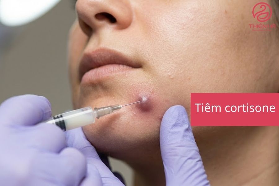Mụn bị chai cứng dưới da phải làm sao? Cách xử lý an toàn 4 Biện pháp y khoa