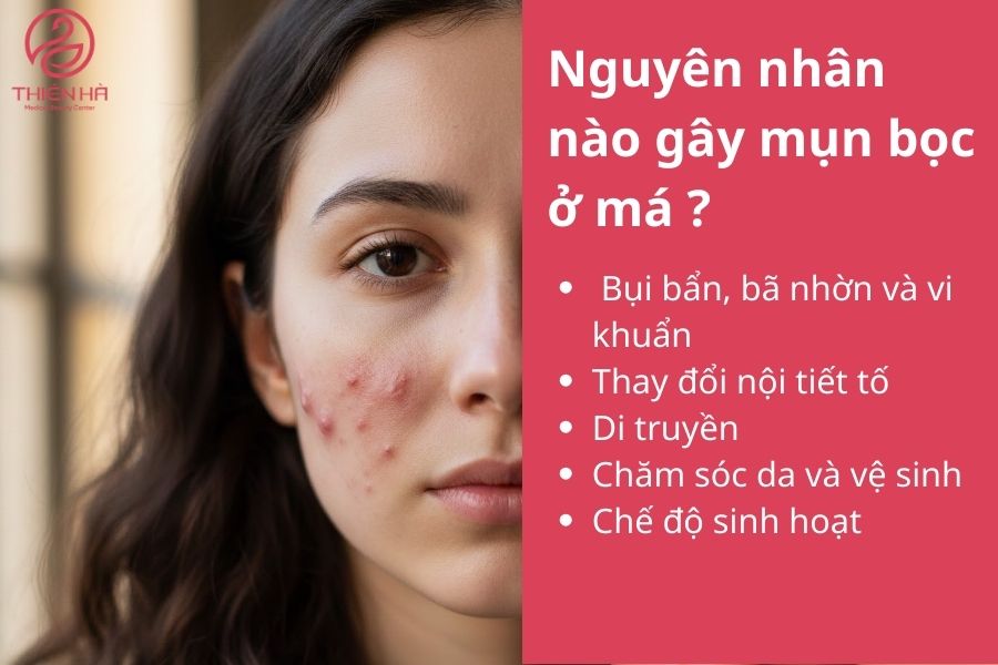 Nguyên nhân nào gây mụn bọc ở má ? 