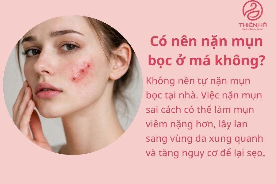 Một số câu hỏi thường gặp về mụn bọc ở má 