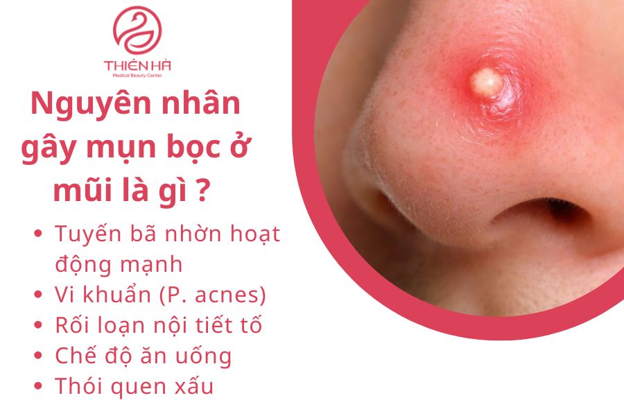 Nguyên nhân gây mụn bọc ở mũi là gì ? 