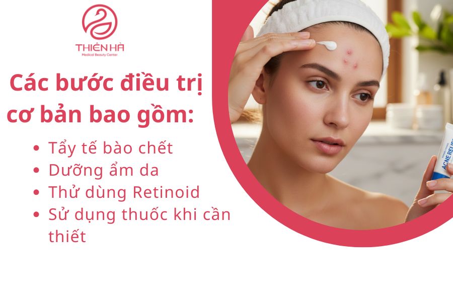 Cách điều trị mụn bọc ở trán như thế nào?