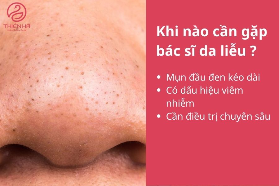 Khi nào cần gặp bác sĩ da liễu ? 