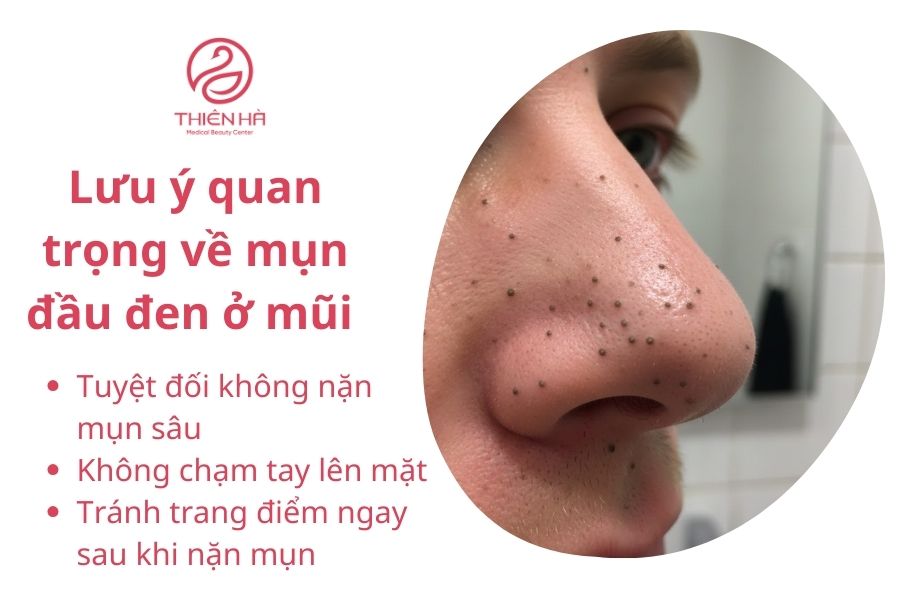 Mụn đầu đen ở mũi: Nguyên nhân và cách điều trị hiệu quả tại nhà 3 Lưu ý quan trọng về mụn đầu đen ở mũi