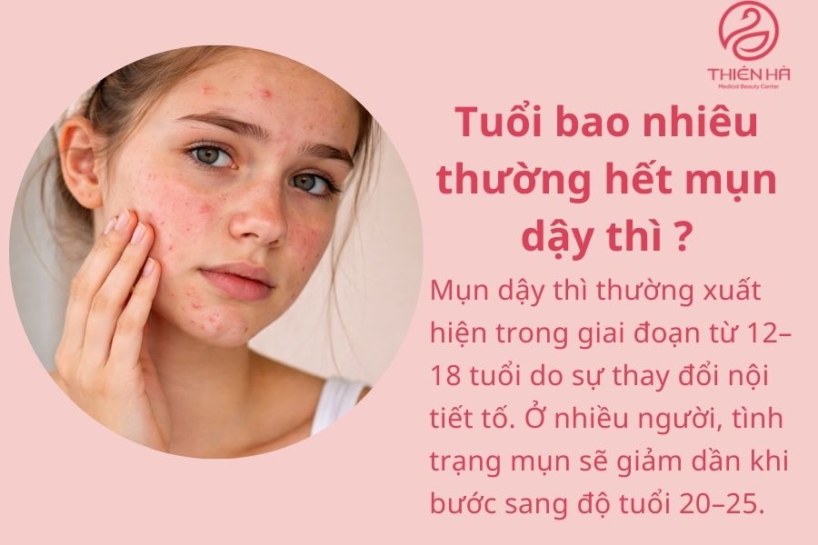 Câu hỏi thường gặp về mụn dậy thì ? 