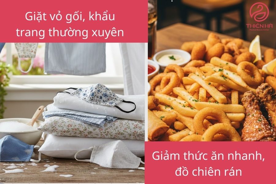 Lối sống giúp giảm mụn dậy thì 