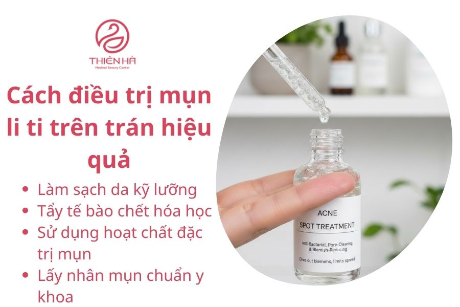 Cách điều trị mụn li ti trên trán hiệu quả