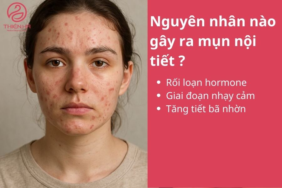 Nguyên nhân nào gây ra mụn nội tiết ? 