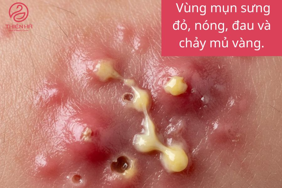 Dấu hiệu cần đi khám bác sĩ
