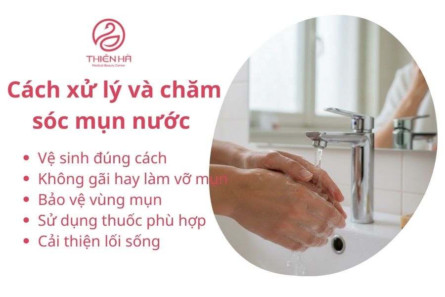 Cách xử lý và chăm sóc mụn nước