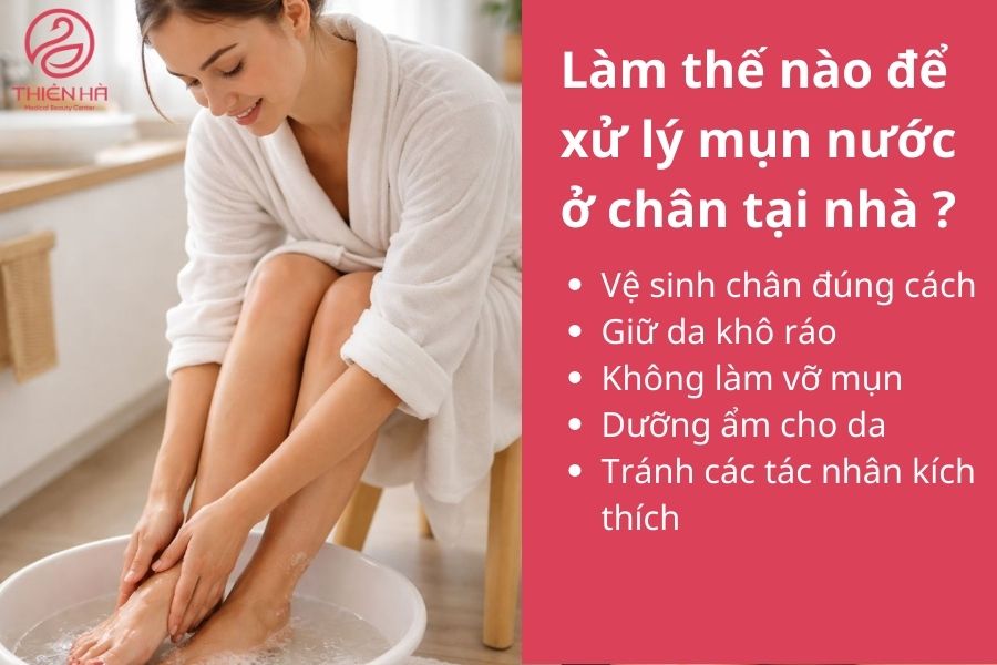 Cách xử lý mụn nước ở chân tại nhà 