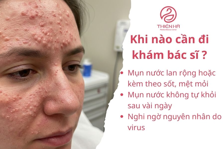 Tất tần tật về mụn nước ở mặt: Nguyên nhân, dấu hiệu & cách điều trị 4 Dấu hiệu cần đi khám bác sĩ