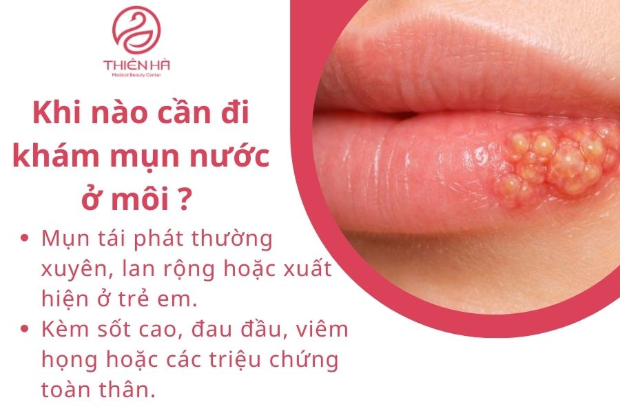 Mụn nước ở môi: Nhận biết, chăm sóc và phòng ngừa tái phát 4 Khi nào cần đi khám mụn nước ở môi ?