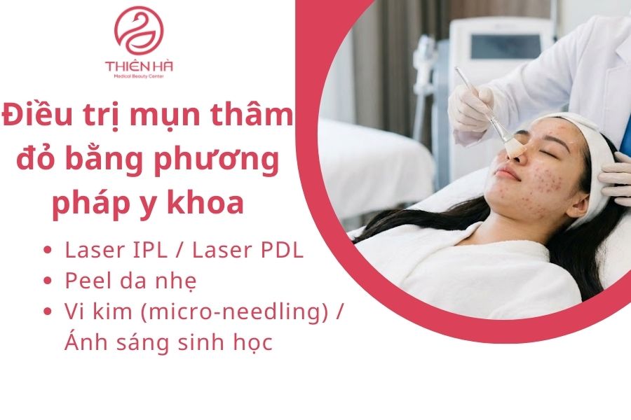 Điều trị mụn thâm đỏ bằng phương pháp y khoa