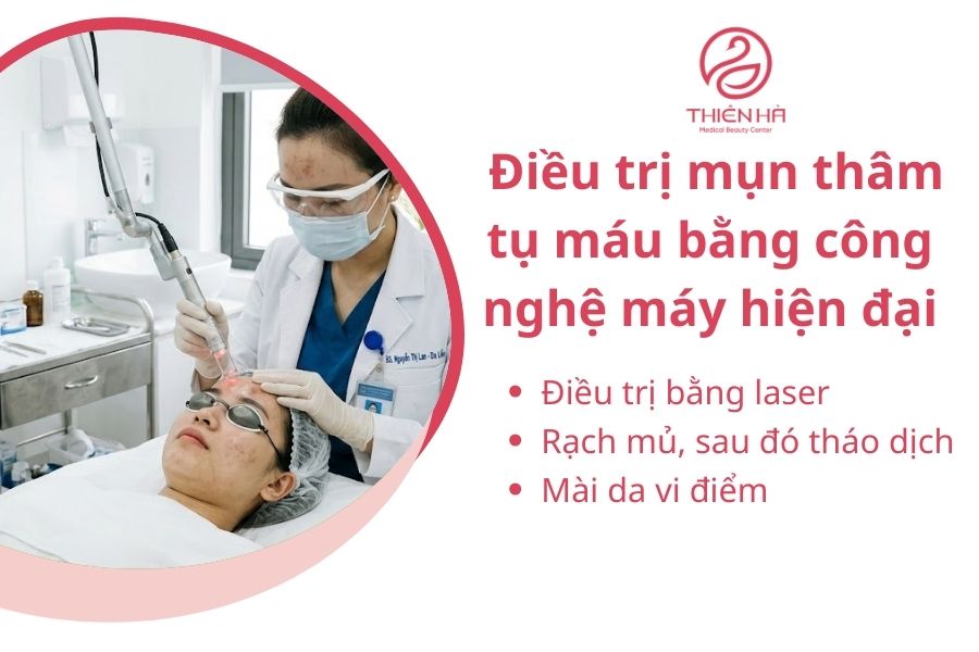 Điều trị mụn thâm tụ máu bằng phương pháp máy bằng công nghệ