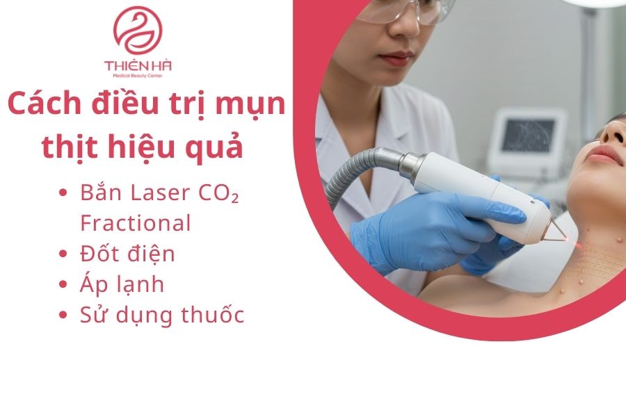 Cách điều trị mụn thịt hiệu quả