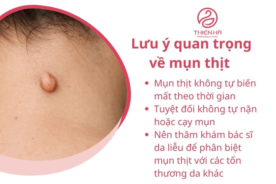 Lưu ý quan trọng về mụn thịt 