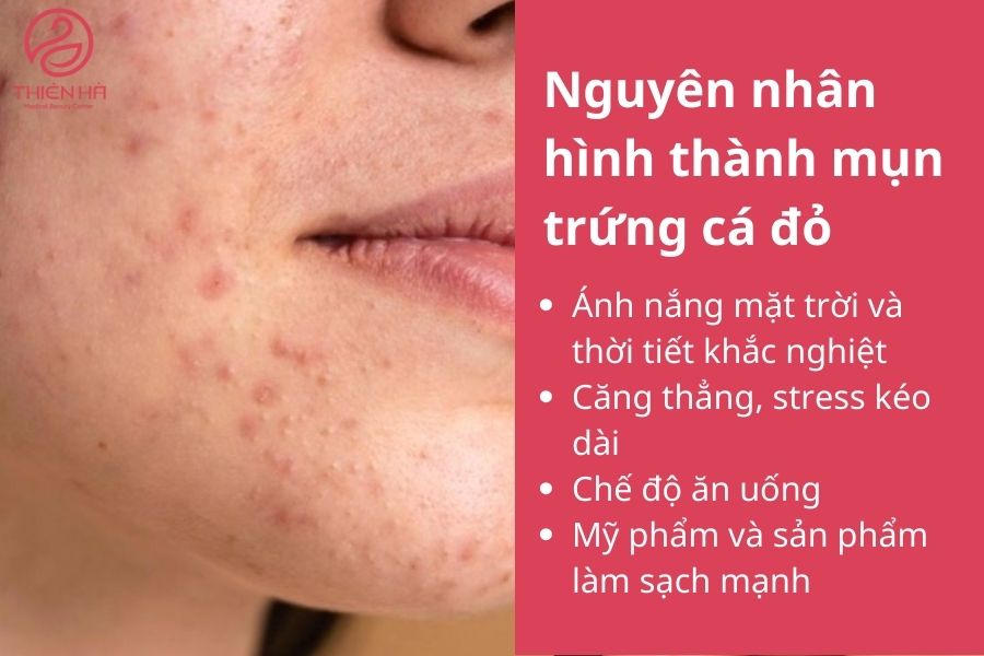 Nguyên nhân hình thành mụn trứng cá đỏ