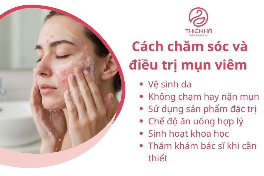 Cách chăm sóc và điều trị mụn viêm 