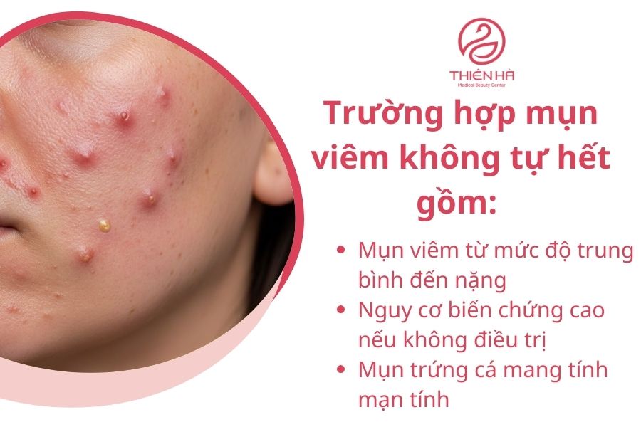 Mụn viêm có tự hết không? Khi nào cần điều trị để tránh thâm sẹo 3 Khi nào mụn viêm sẽ không tự hết và cần can thiệp ?