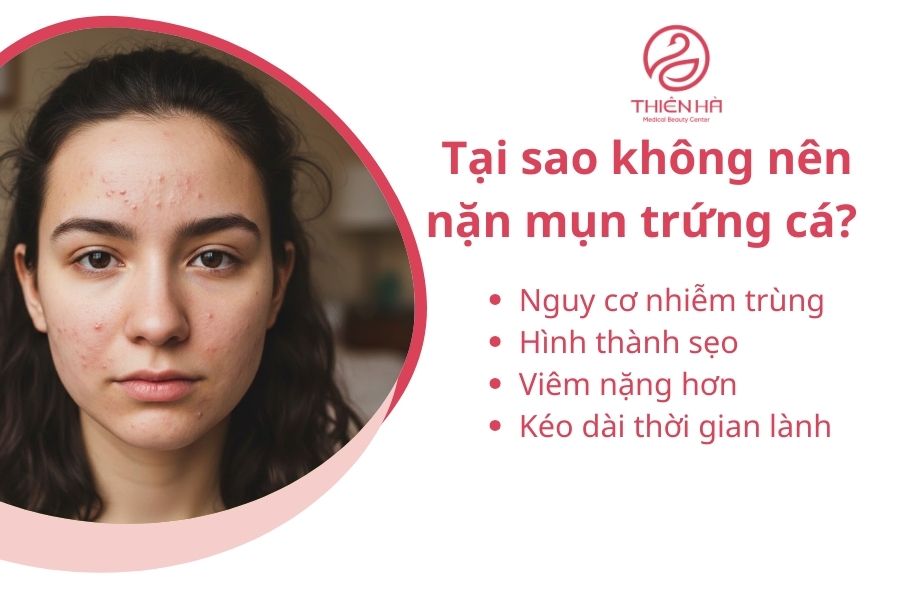 Nặn mụn trứng cá có nên không? Khi nào nặn an toàn cho da ? 2 Tại sao không nên nặn mụn trứng cá?