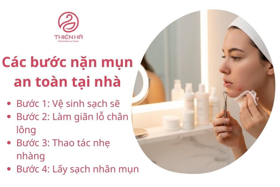 Nặn mụn trứng cá có nên không? Khi nào nặn an toàn cho da ? 4 Các bước nặn mụn an toàn tại nhà