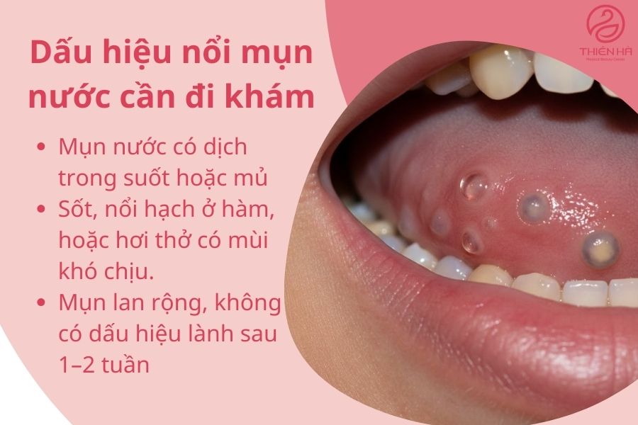 Dấu hiệu cần đi khám