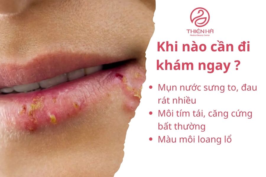 Dấu hiệu cần đi khám ngay 