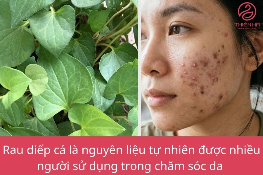 Rau diếp cá trị mụn thâm
