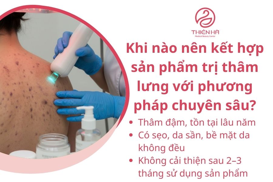 Khi nào nên kết hợp sản phẩm trị thâm lưng với phương pháp chuyên sâu?