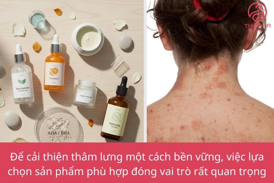 Tiêu chí chọn sản phẩm trị thâm lưng hiệu quả, an toàn