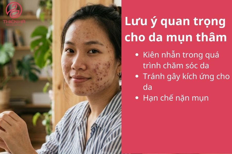 Lưu ý quan trọng cho da mụn thâm 