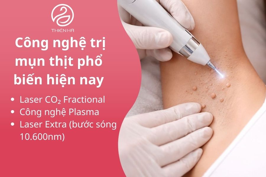 Công nghệ spa trị mụn thịt phổ biến hiện nay