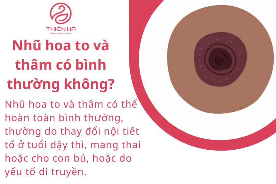 Nhũ hoa to và thâm có bình thường không?