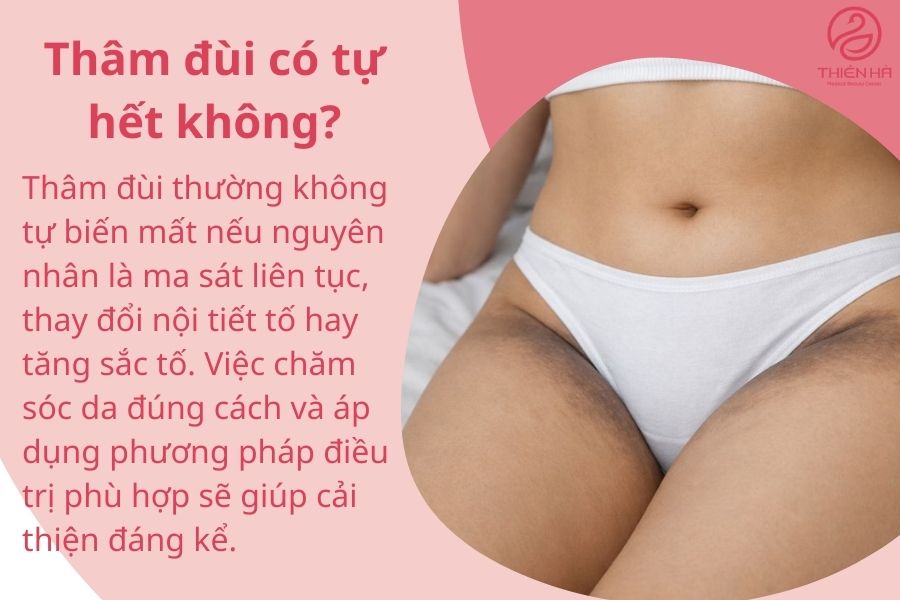 Thâm đùi có tự hết không?