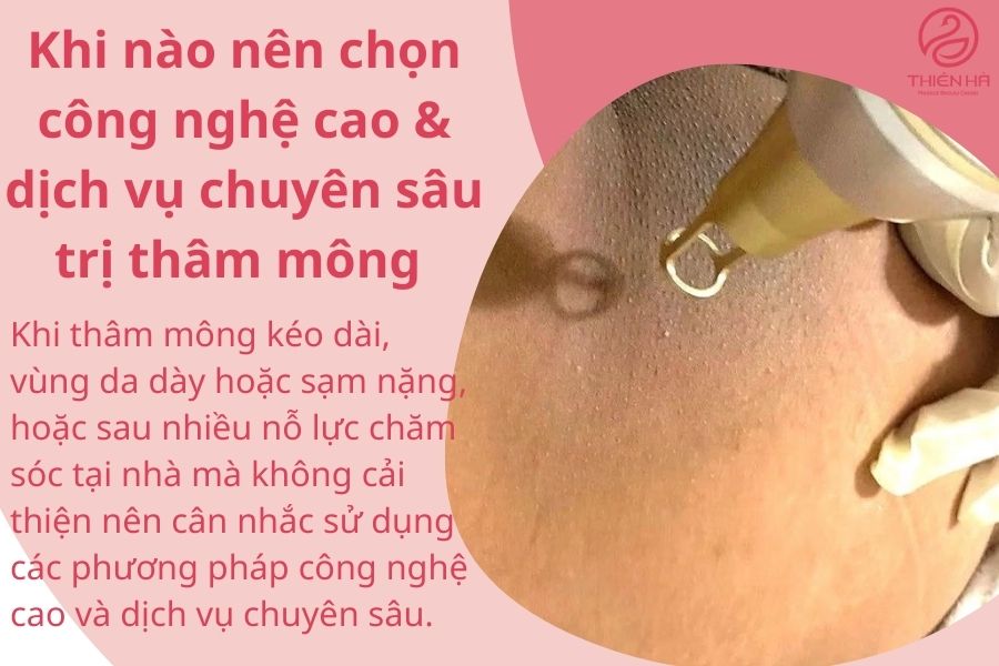 Khi nào nên chọn công nghệ cao & dịch vụ chuyên sâu để trị thâm mông 
