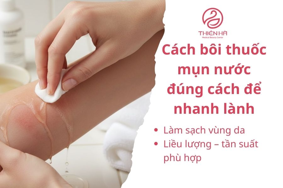 Cách bôi thuốc mụn nước đúng cách để nhanh lành